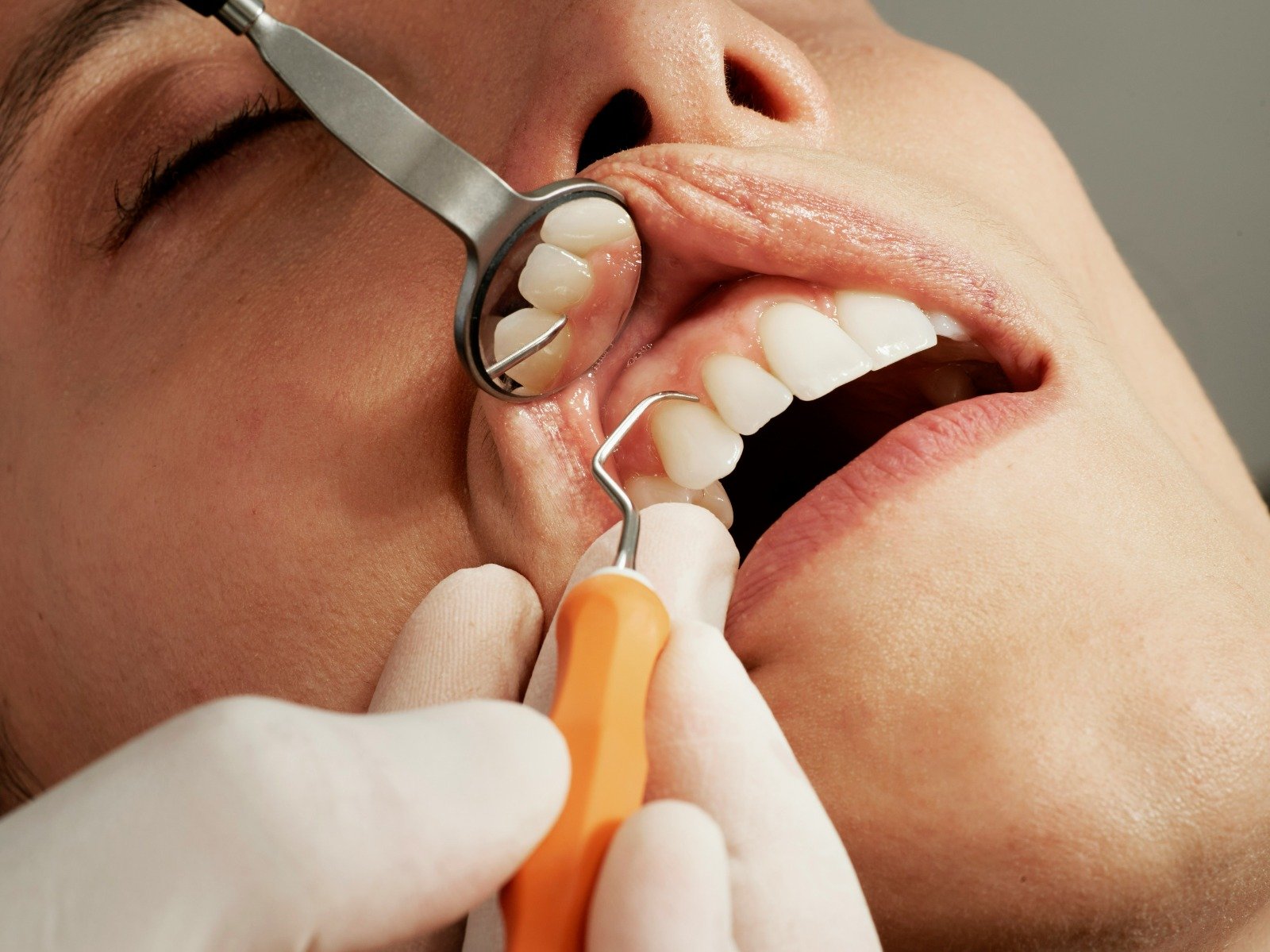 General Dentistry in Surat