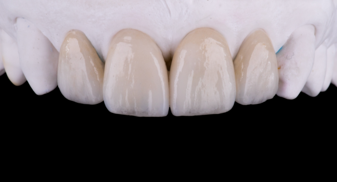 Cosmetic Dentistry Services at Cuspid Dental in Surat