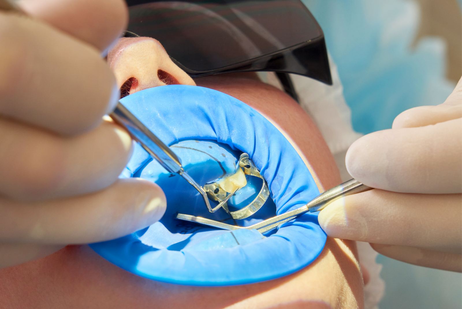 Aesthetic Dental Services in Surat