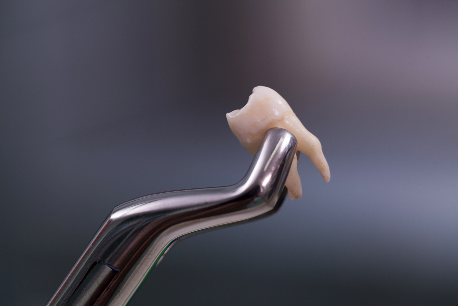 Expert Oral Surgery Services in Surat