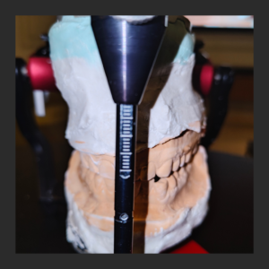 Articulated dental models used for full mouth rehabilitation planning and bite analysis